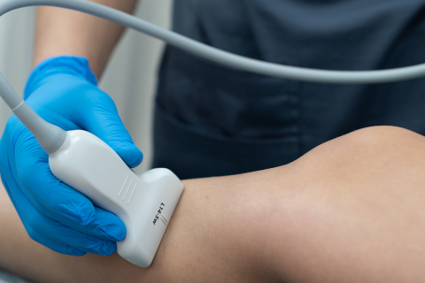 Варикоз и курение - влияние на сосудистую стенку 