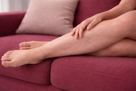 Как понять, что сосудистая сетка требует лечения